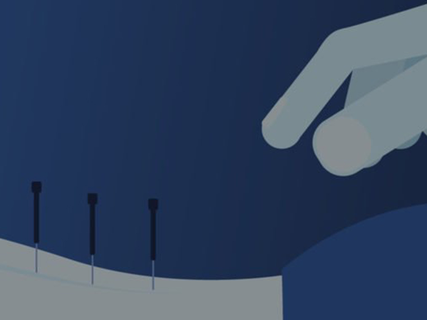 Medicina Alternativa – O que a acupunctura pode fazer por si
